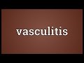 Vasculitis Meaning