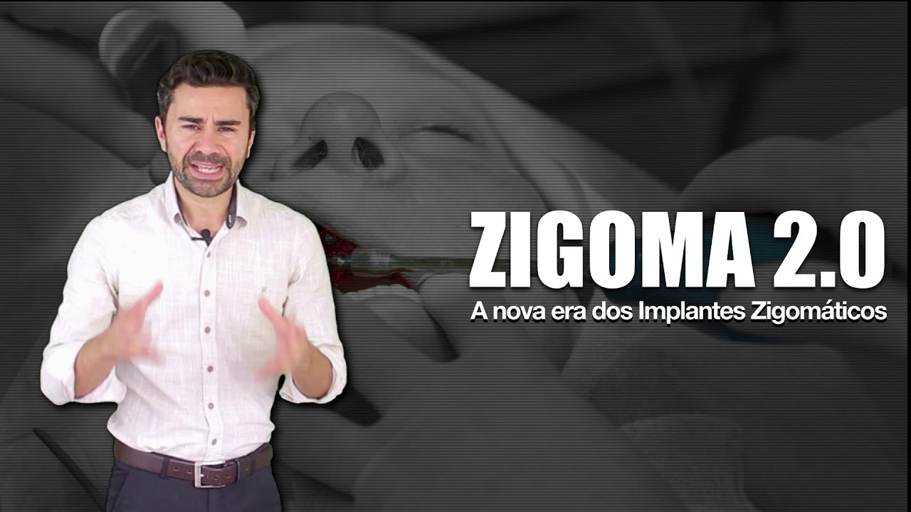ZIGOMA 2.0 - A Nova Era dos Implantes Zigomáticos