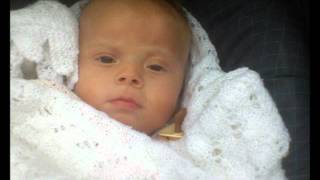Pallister Killian sindrom