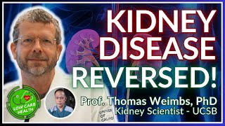 028 Reversing Chronic Kidney Disease Ckd A Keto Breakthrough With Prof. Thomas Weimbs, Phd