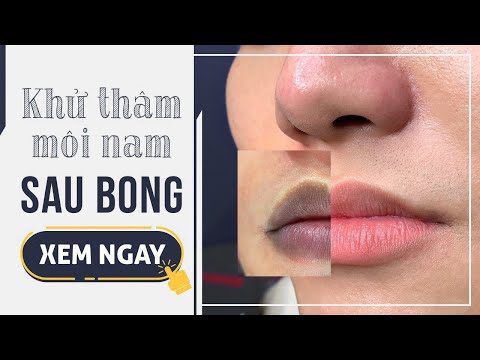 Kết quả tuyệt vời sau khử thâm môi nam | Master Quỳnh Nga