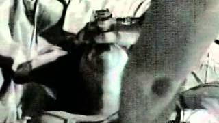 911Biomed - Cardiac Arrest