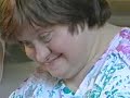 Down's syndrome