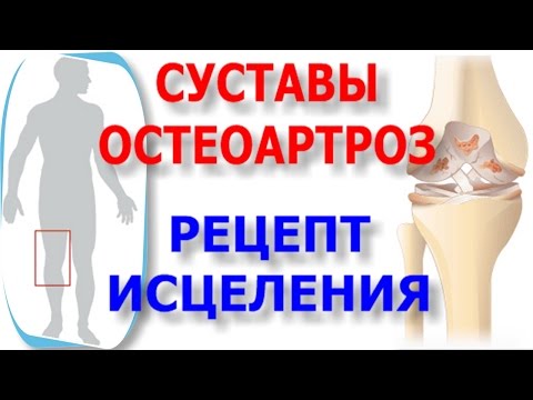 Лечение воспаление суставов народными средствами в домашних условиях Лечение воспаление суставов народными средствами в домашних