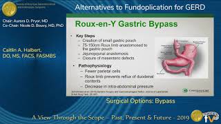 Surgical Options: Bypass