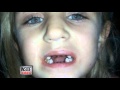 Stop Dental Abuse - Inside Edition (CBS) Covers the Dr. Schne...