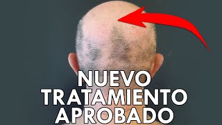 FÁRMACO APROBADO para ALOPECIA autoinmune