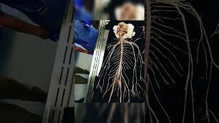 real nervous system #anatomy #human #body