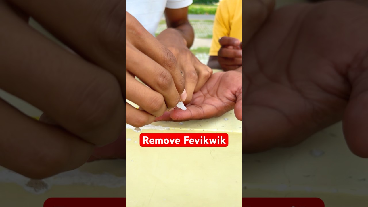 How To Remove Feviquick From Hand? #tricks #shorts How To Remove Feviquick From Hand? #tricks #shorts