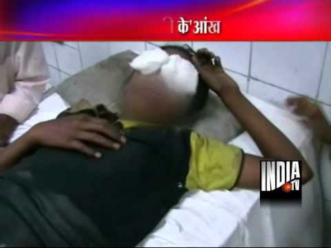 Horror In UP Girl Resisting Rape Loses Eye A 14yearold dalit girl 