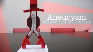 Silent Killers - Aneurysm | DAVID ESPOSITO, M.D. - MVI TV