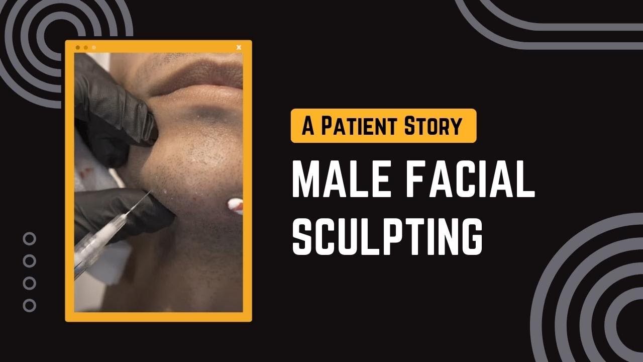 Facial sculpting surgery