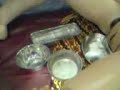 Ganti Kelamin Wanita - Dewasa 18+