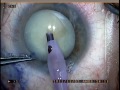 surgery
