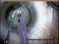 surgery