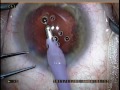 surgery