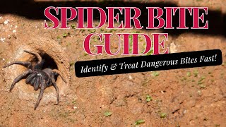 Spider Bite Guide Identify & Treat Dangerous Bites Fast