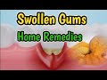 Swollen Gums Home Remedies | Tips To Reduce Swollen Gums At Home |