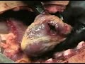 AUTOPSIA
