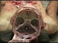 AUTOPSIA