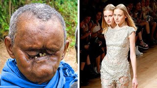 10 Most Unusual And Bizarre People To Ever Exist