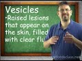 Chemical Weapons-Blister Agents (Lesson 2 Chemical Weapons)