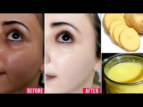 SKIN WHITENING Overnight / Apply it in 5 Minutes before Sleep/ FAIR SPOTLESS GLOWING SKIN II NGWorld