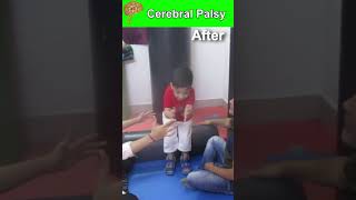 He Is A 5.5 Year Old Case Of Spastic Diplegic Cp