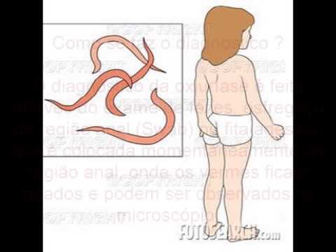 Parasitas em orelhas no momento do tratamento de pessoa