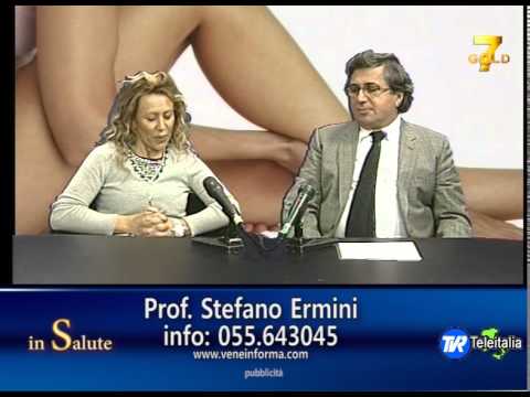 Che mangiare a varicosity di vene di gambe
