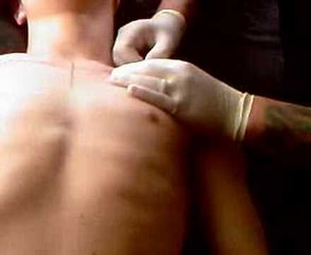 Description for Horizontal Clavicle Surface Piercing Description for Horizontal Clavicle Surface Piercing
