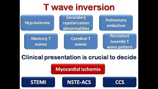 Ecg Course T Wave Inversion, Dr. Sherif Altoukhy