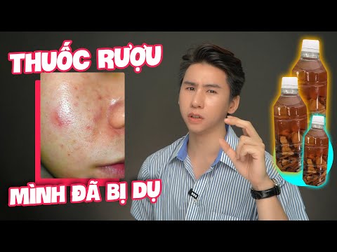 ⛔dính THUỐC RƯỢU & lời cảnh tỉnh ⛔ cách mình đã TỰ VƯỢT QUA quá trình CHƠI THUỐC RƯỢU đến banh da !
