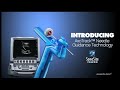 AxoTrack™ Needle Guidance Technology Demonstration - SonoSite Ultrasound