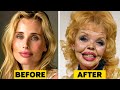 20 Times Plastic Surgery Went Horribly Wrong