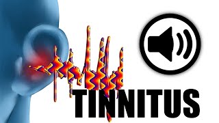 Tinnitus Sound Effect Hd No Copyright