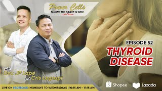 Tmsd 2Nd Edition Episode 52 Thyroid Disease