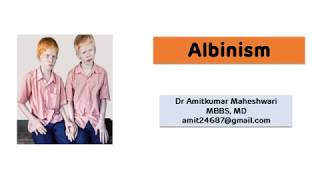 Albinism Deficiency Of Tyrosinase
