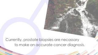 Debunking Myths Do Prostate Biospies Spread Cancer?