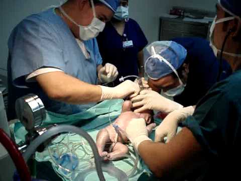 Lfk para sheynogo de la columna vertebral a la osteocondrosis