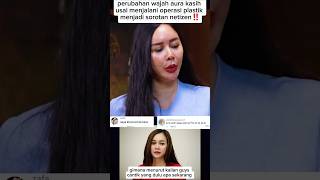 Perubahan Wajah Aura Kasih Setelah Operasi Plastik Jadi Sorotan Netizen