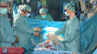 Minimally invasive approach for infective mitral valve endocarditis