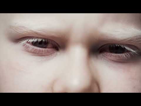 Stennes - Eyes Didn't Let Me Open