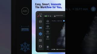 Edan Nano Series Workflow With Precision At Every Step
