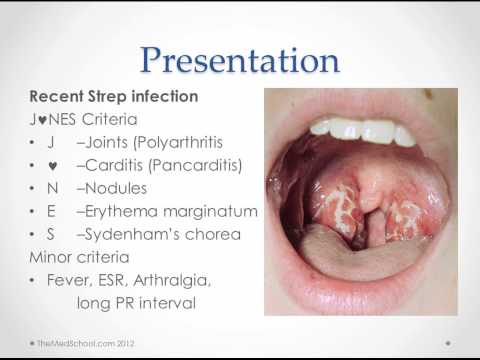 rheumatic fever more condition symptoms