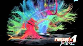Scientists produce most detailed map of the brain in 3D Scientists produce most detailed map of the brain in 3D
