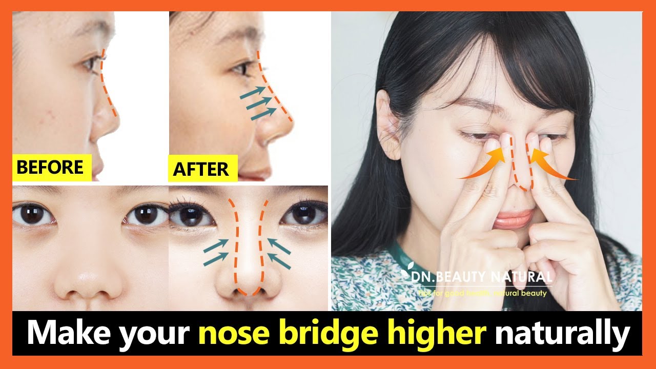 Asian nose bridge