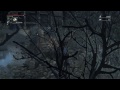 ♥ Bloodborne (Let's Play) - #18 Which Forest