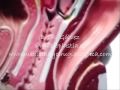Bioplastia del placer sexual Punto G vaginal y aumento del grosor del pene. Dr Gálvez .Macrolane