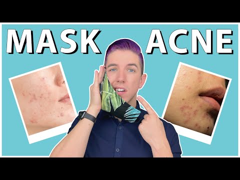 How to Prevent & Get Rid of "Maskne" - YouTube